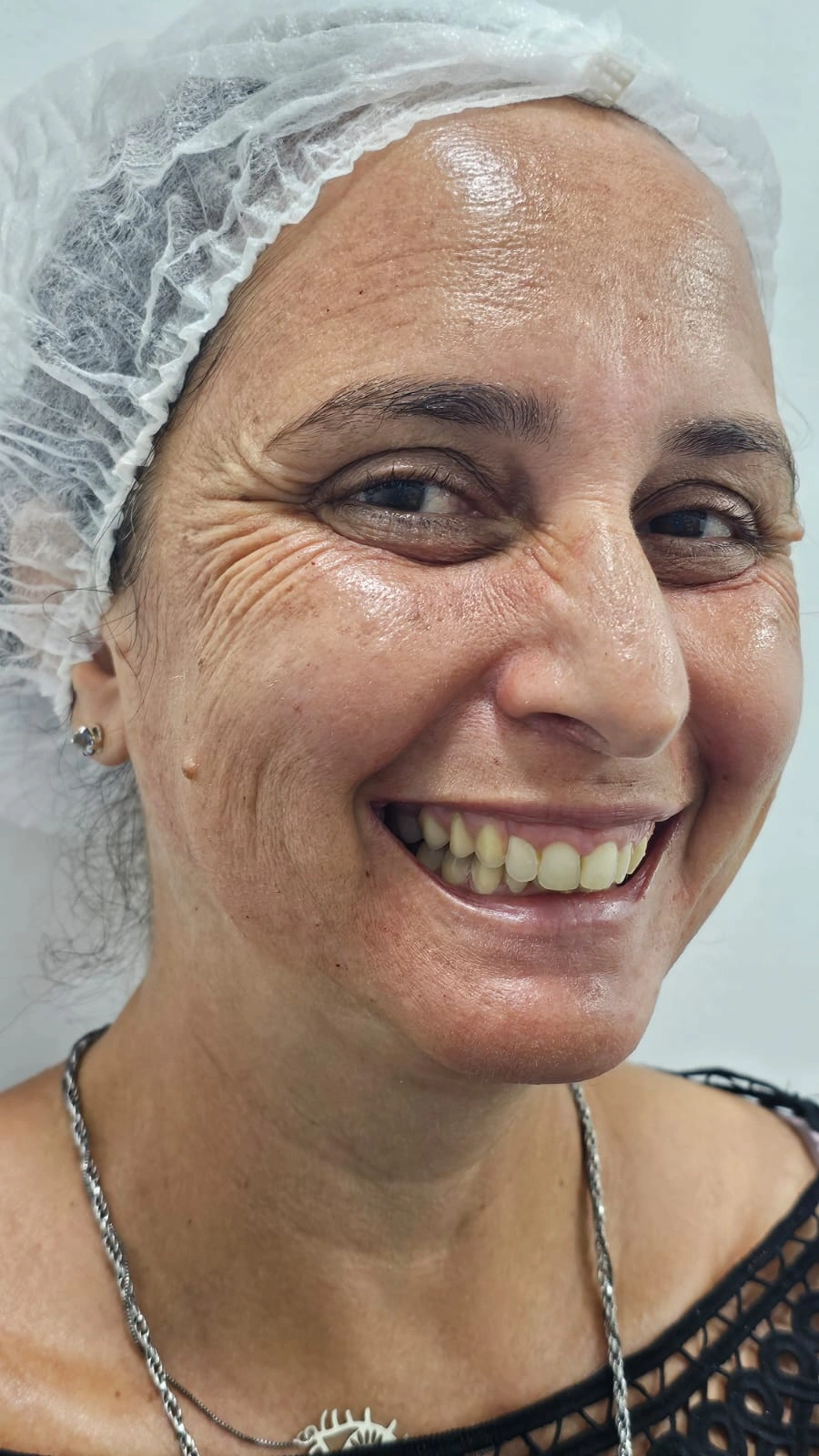 Caso clínico antes do tratamento — Dra. Marcia Maia CRO-RJ 26328